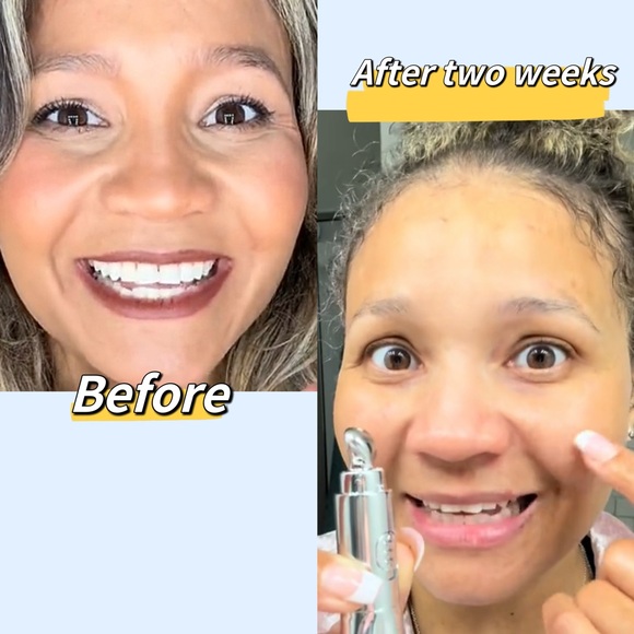 Retinol Eye Cream With Electric Massage Anti-Wrinkle for Puffiness & Bags - Picture 3 of 11